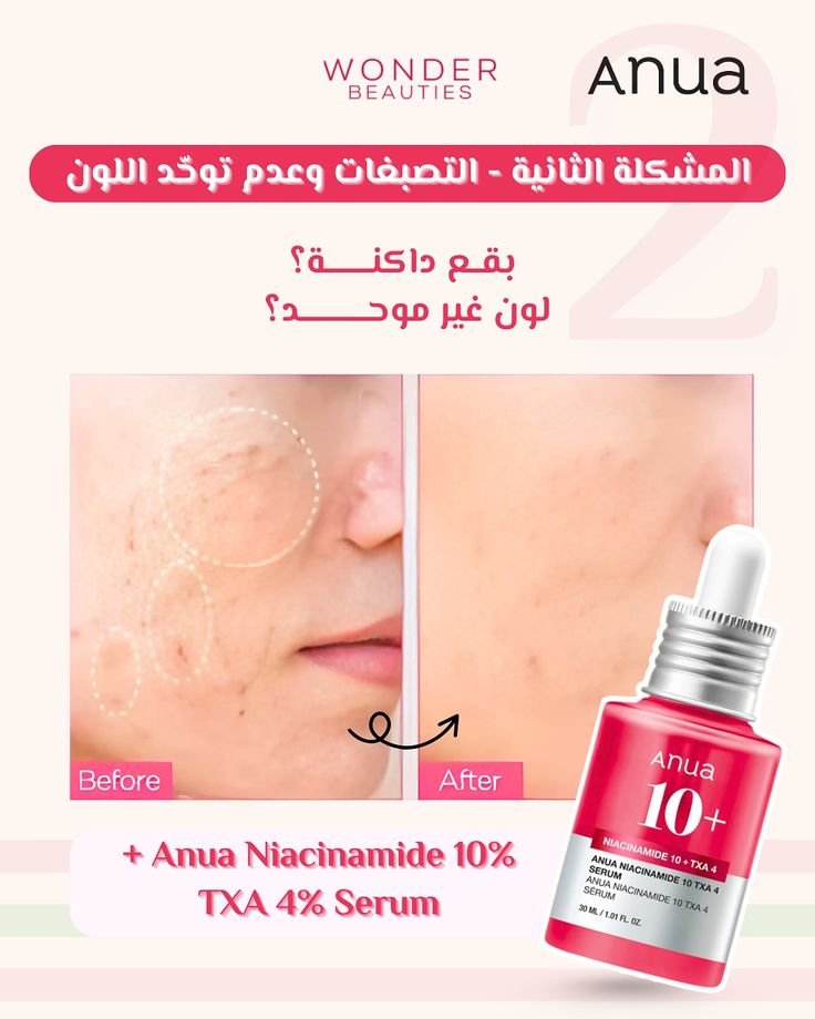 Dark Spot Serum for Glowing Skin – Even Skin Tone