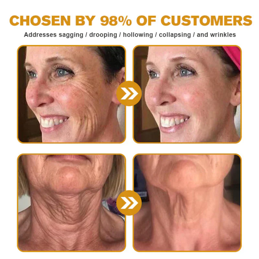 Botox Bee Venom Wrinkle Cream